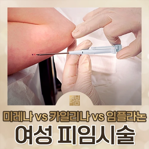 미레나 카일리나 임플라논, 나에게 맞는 피임법 고르는 기준은?