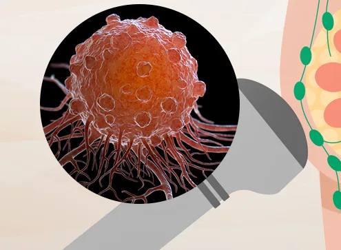 Anatomy illustration related to A Lump Was Found on Breast Ultrasound: Should You Worry Right Away?