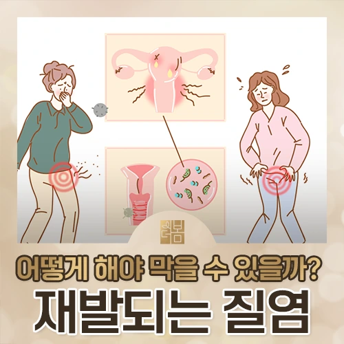 질염이 자꾸 재발하는 이유, 어디서부터 다시 봐야 할까요?