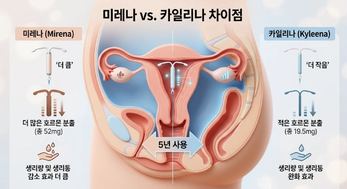 미레나 카일리나 임플라논, 나에게 맞는 피임법 고르는 기준은? 관련 해부 구조 그림